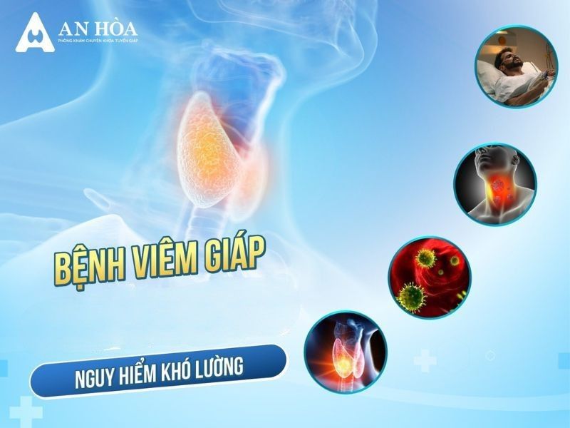Bệnh viêm tuyến giáp