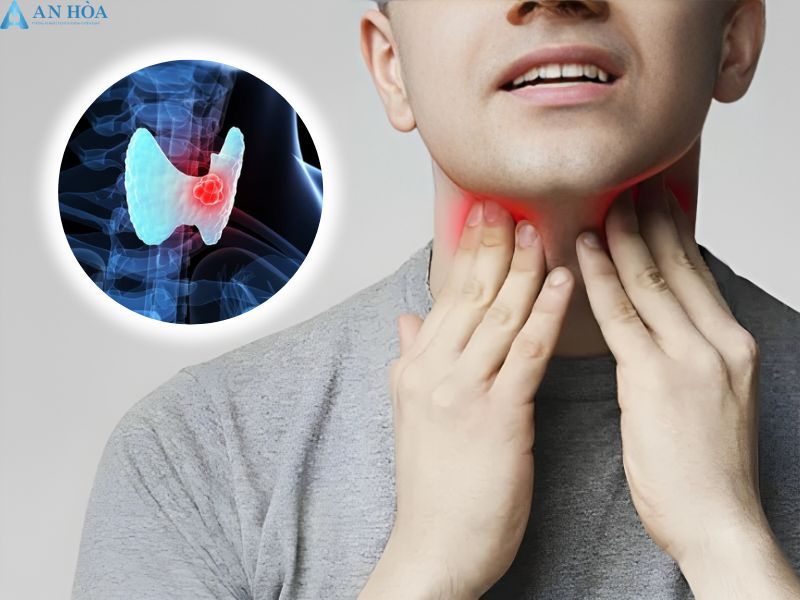 K tuyến giáp có chữa được không