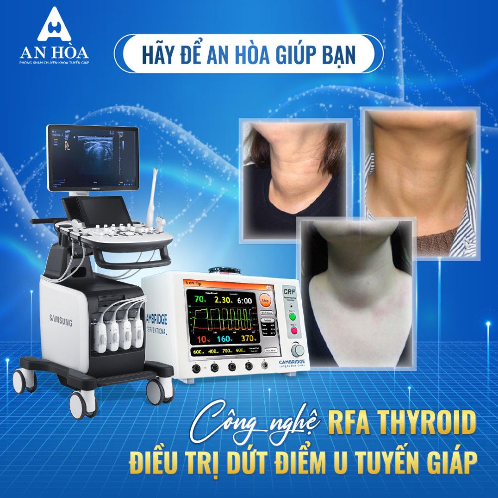 Mổ bướu tuyến giáp
