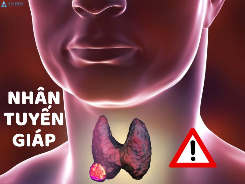 Mổ nhân tuyến giáp có nguy hiểm không