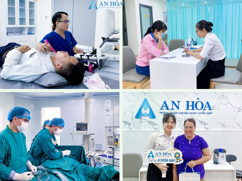 Viêm giáp mạn tính