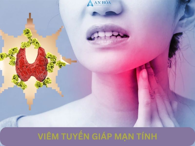 Viêm giáp mạn tính