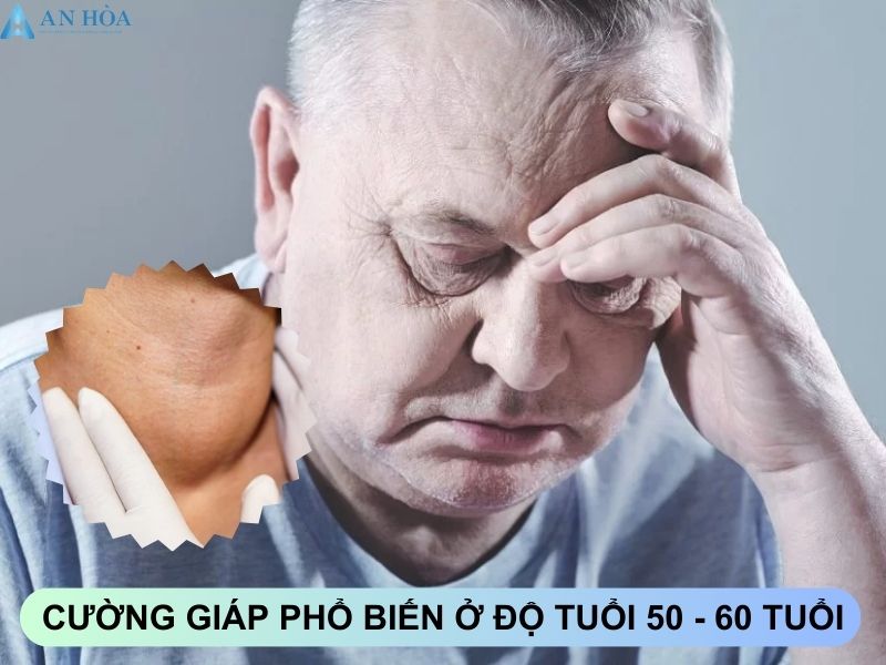 Bệnh cường tuyến giáp ở nam giới