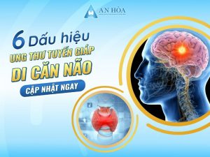 Dấu hiệu ung thư tuyến giáp