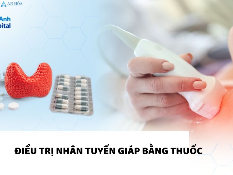 Điều trị bệnh bướu cổ