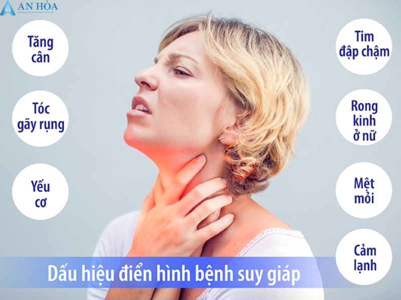 Điều trị viêm giáp