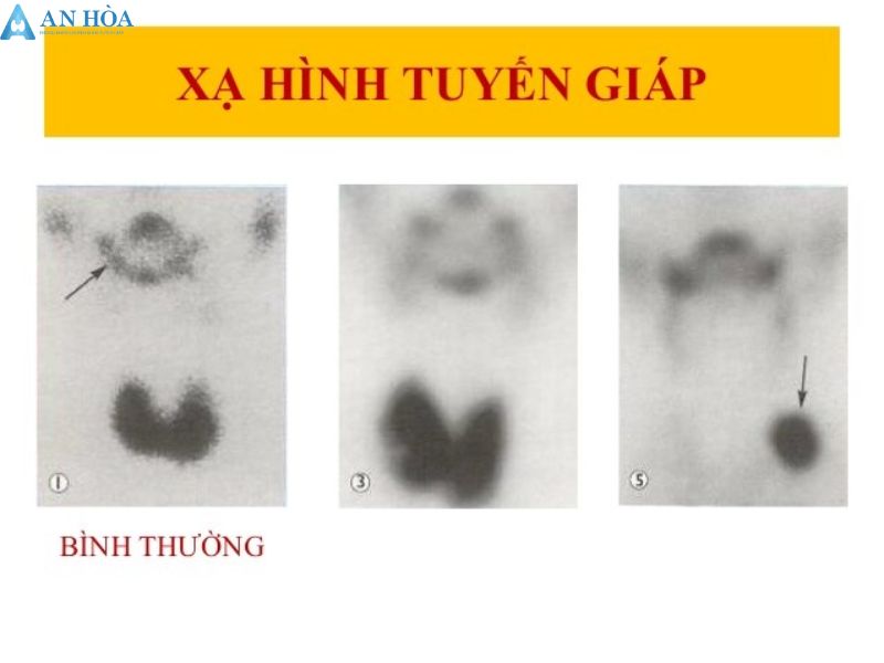 Kiểm tra chức năng tuyến giáp