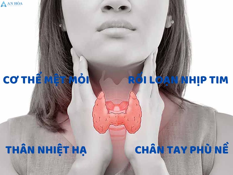Nguyên nhân hàng đầu gây suy giáp