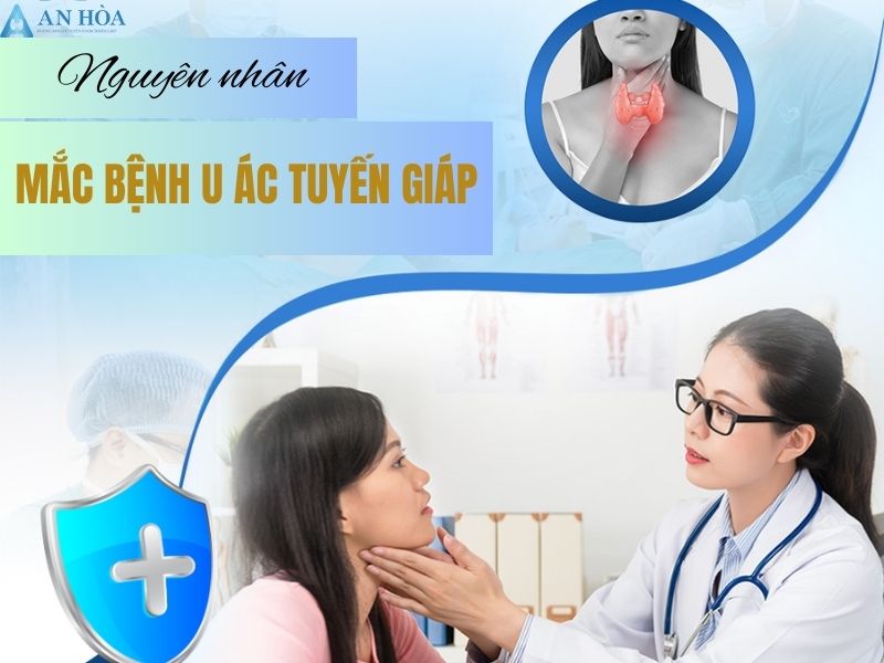 U ác tuyến giáp có chữa được không