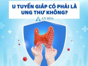 U tuyến giáp có phải là ung thư không