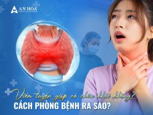 Viêm tuyến giáp có chữa khỏi không