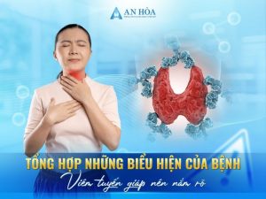Biểu hiện của bệnh viêm tuyến giáp
