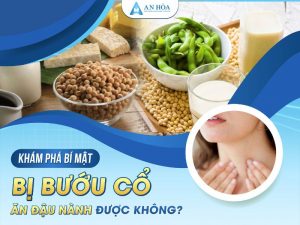 Bướu cổ ăn đậu nành được không