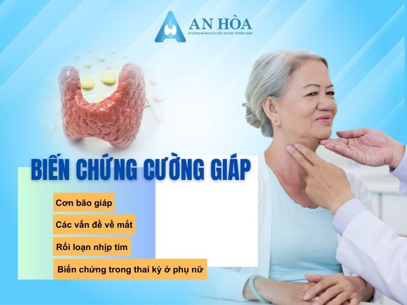 Cách chữa cường giáp