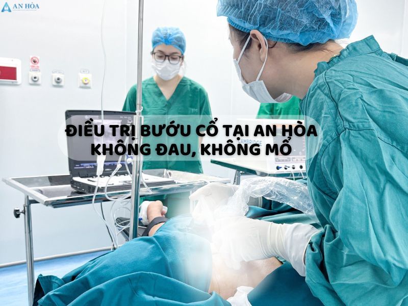 Điều trị bướu cổ