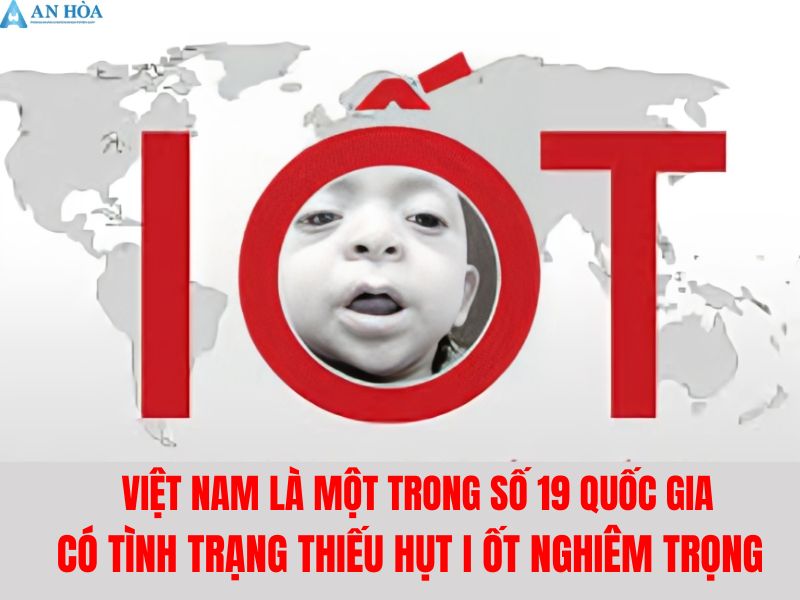 Nguyên nhân của bệnh bướu cổ