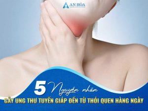 Nguyên nhân gây ung thư tuyến giáp