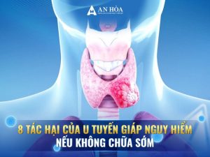 Tác hại của u tuyến giáp