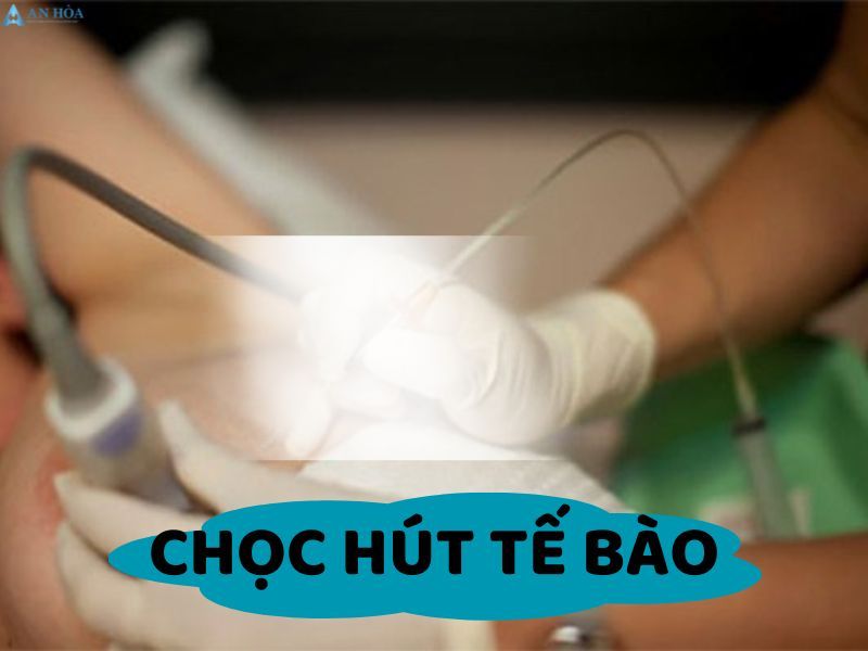 Tuyến giáp độ 2