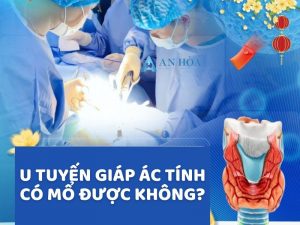 U tuyến giáp ác tính có mổ được không