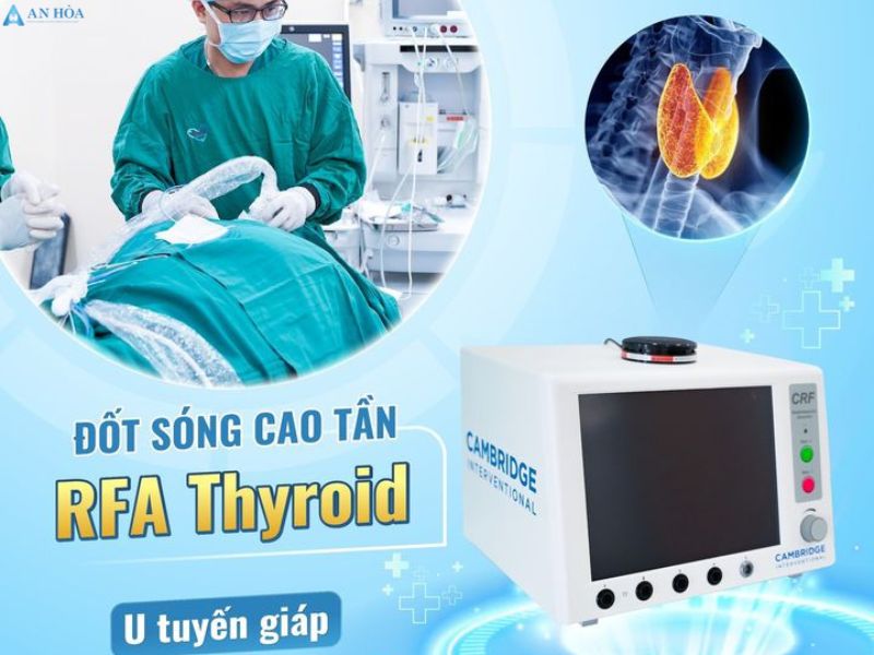 U tuyến giáp nhỏ