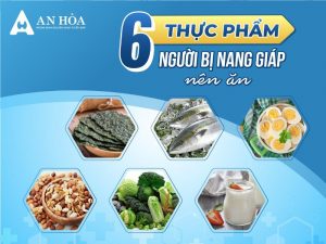 Bị nang tuyến giáp