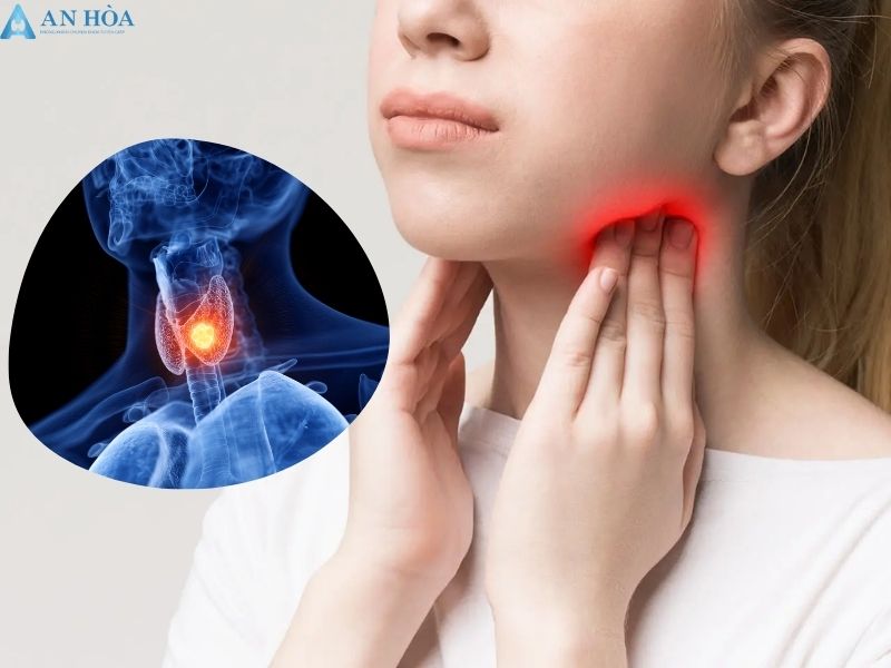 Cách chữa bệnh tuyến giáp