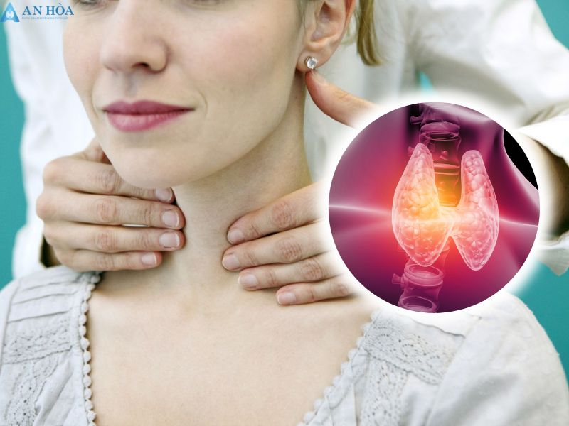 Cách chữa bệnh tuyến giáp