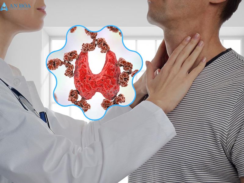 Cách chữa viêm tuyến giáp