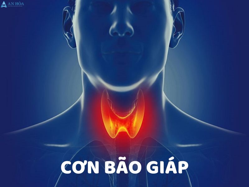 Cường giáp ở nam giới
