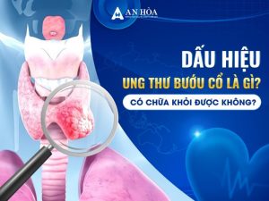 Dấu hiệu ung thứ bướu cổ