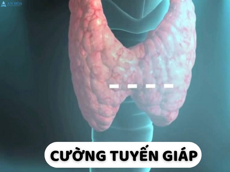 Đau tuyến giáp cổ