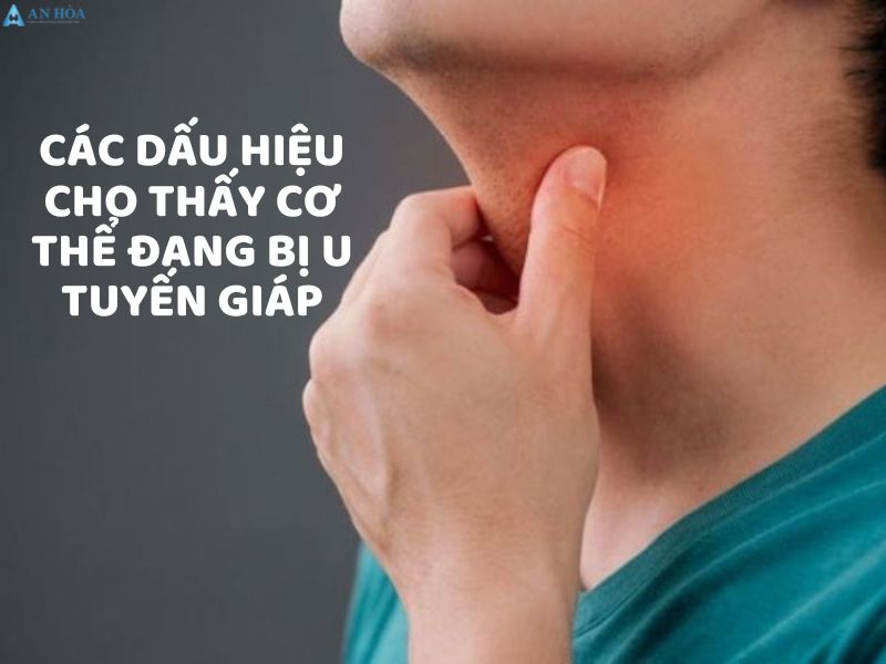 Điều trị u tuyến giáp lành tính