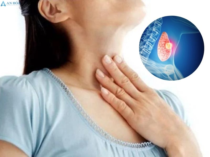 Điều trị u tuyến giáp lành tính