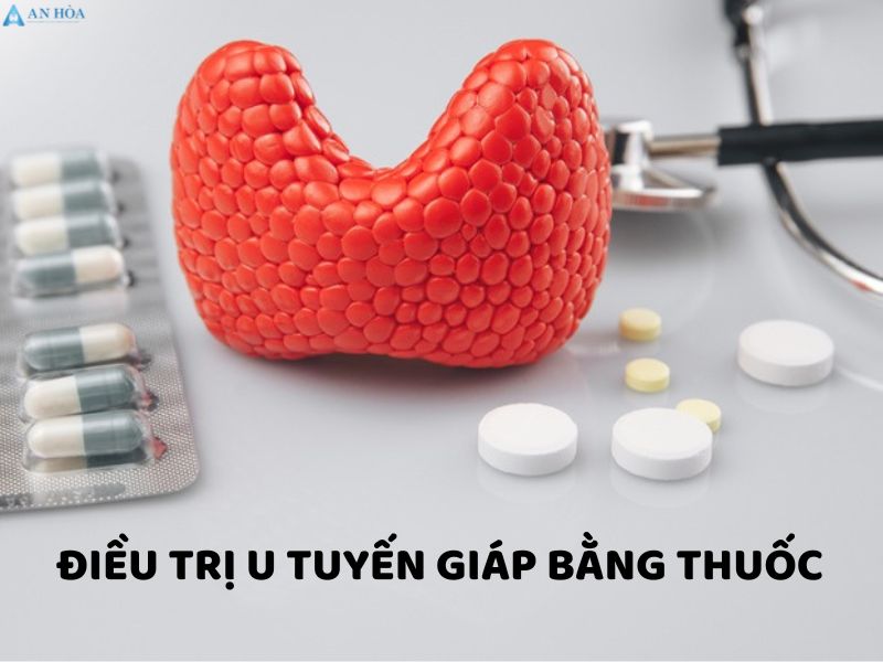 Điều trị u tuyến giáp lành tính