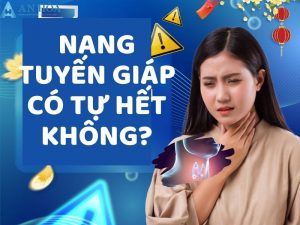 Nang tuyến giáp có tự hết không