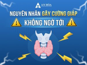 Nguyên nhân gây cường giáp