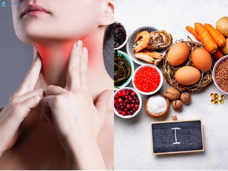 Nguyên nhân gây cường giáp
