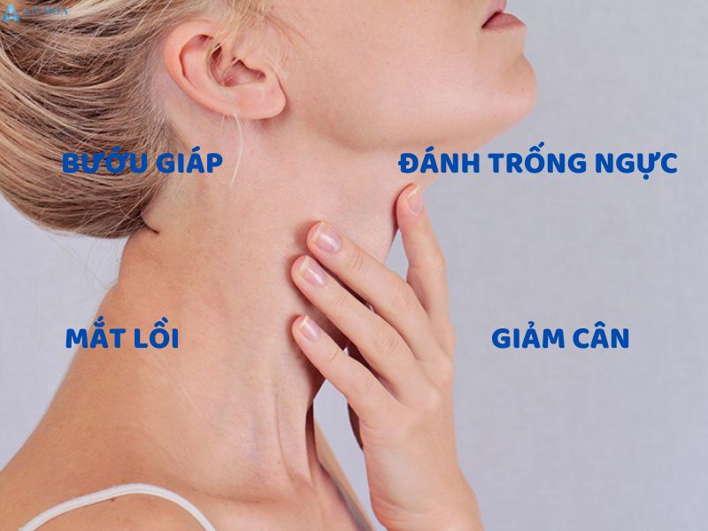 Nguyên nhân gây cường giáp