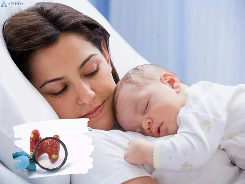U nước tuyến giáp