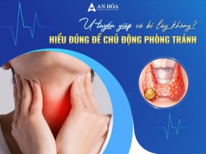 U tuyến giáp có bị lây không