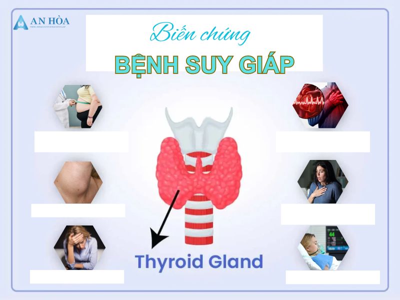 Bệnh suy giảm tuyến giáp