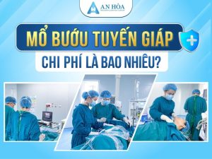 Chi phí mổ bướu tuyến giáp