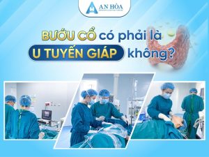 Bướu cổ có phải là u tuyến giáp không