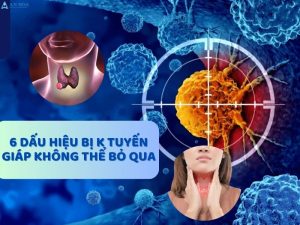 Dấu hiệu bị k tuyến giáp