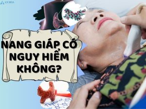 Nang tuyến giáp có nguy hiểm không