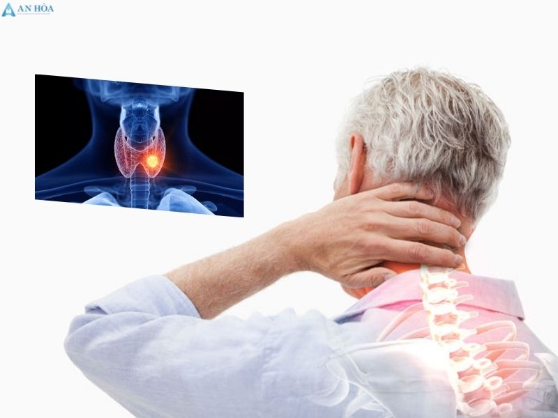 Nhân tuyến giáp thùy phải