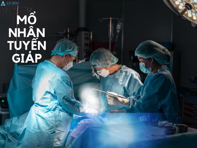 Nhân tuyến giáp thùy phải
