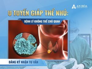 U tuyến giáp thể nhú