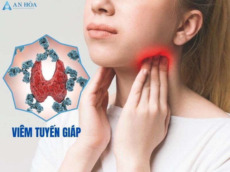 Thức ăn tốt cho tuyến giáp